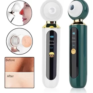 EXTRACTOR ESPINILLAS Y PUNTOS NEGROS